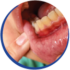 iconos dentales_Periodoncia